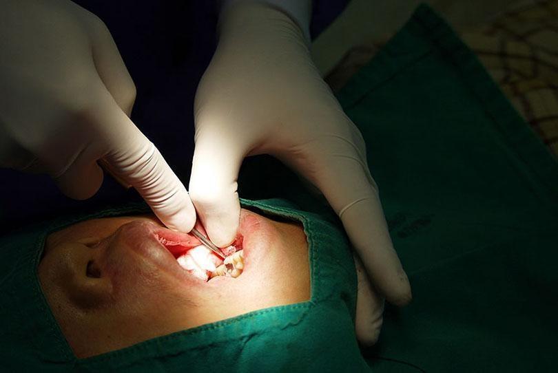 dentist suspended wrongful death