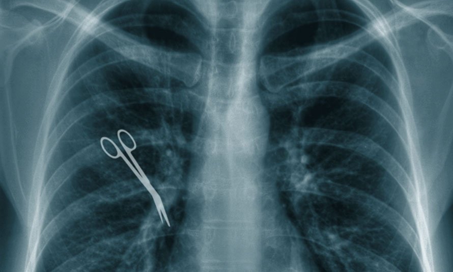 nyc medical malpractice surgical errors leave object